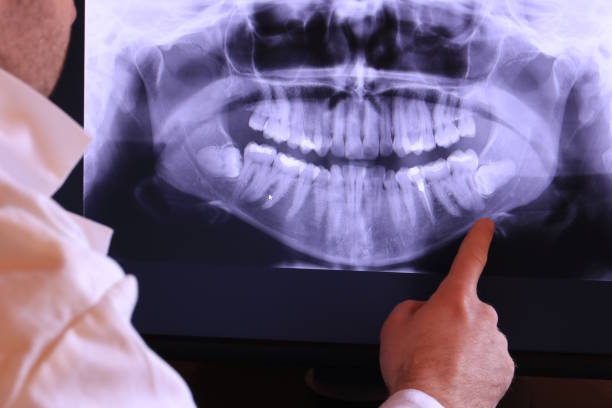 Best Emergency Denture Repair in Curtice, OH