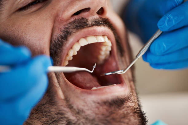 Best Emergency Dental Care for Broken or Chipped Teeth in Curtice, OH