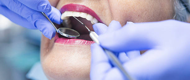 Best Urgent Care for Lost Fillings or Crowns in Curtice, OH